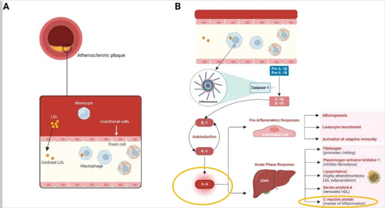 Diagram showing IL-6 triggering CRP production in plaque formation