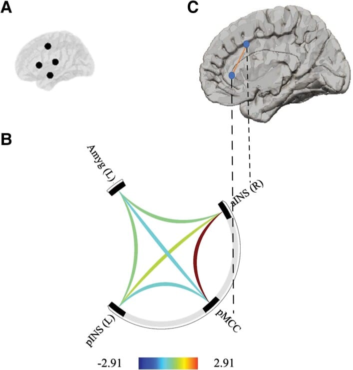 Central autonomic network connectivity associated with parasympathetic HRV during slow-wave sleep