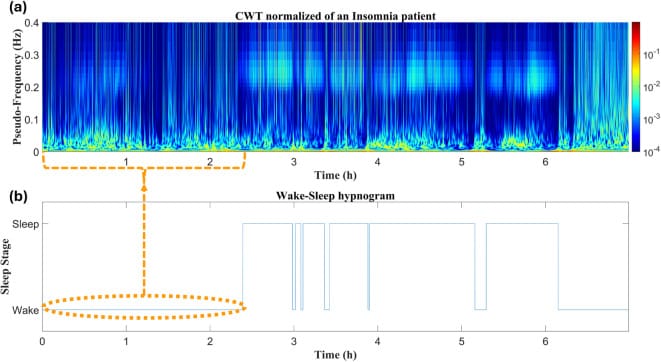 HRV time-frequency distribution across the night in an insomnia patient