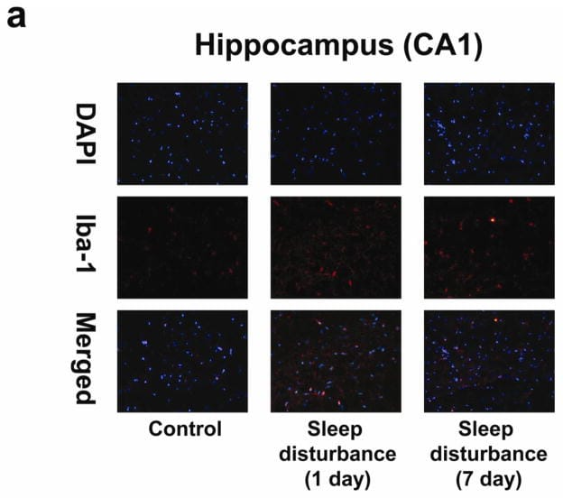 Sleep disturbance induces microglial activation in mouse hippocampus CA1