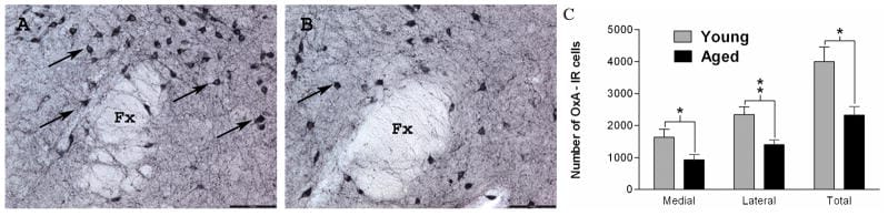 Age-related reduction in orexin neurons in rat hypothalamus