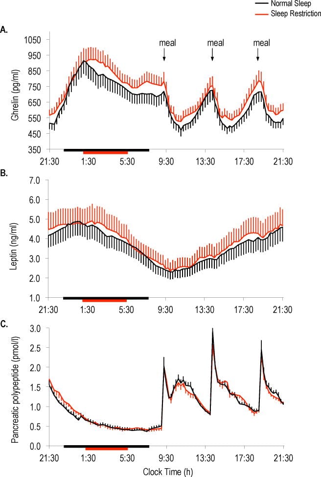 Twenty-four hour profiles of ghrelin, leptin, and pancreatic polypeptide under normal sleep and sleep restriction