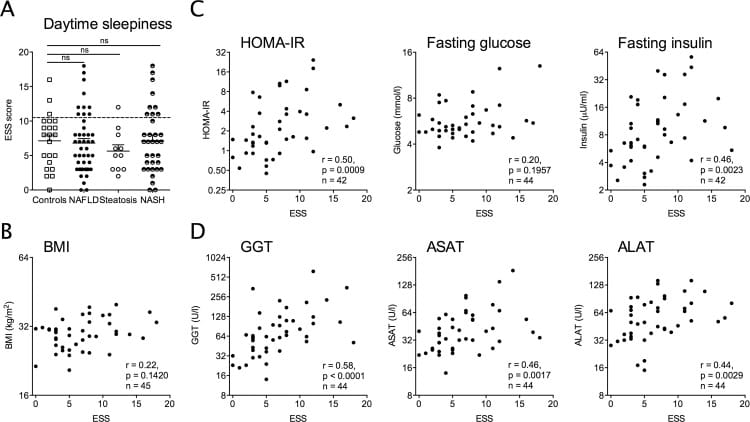 Daytime sleepiness in patients with Non-alcoholic fatty liver disease (NAFLD) is linked to insulin resistance and elevated liver enzymes