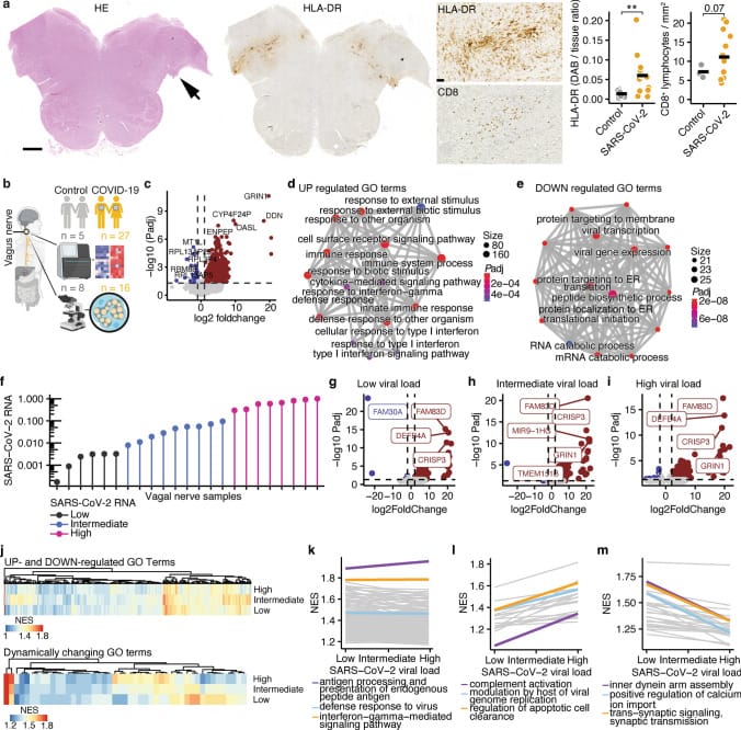 Histopathology and gene expression analysis of vagus nerve inflammation in COVID-19