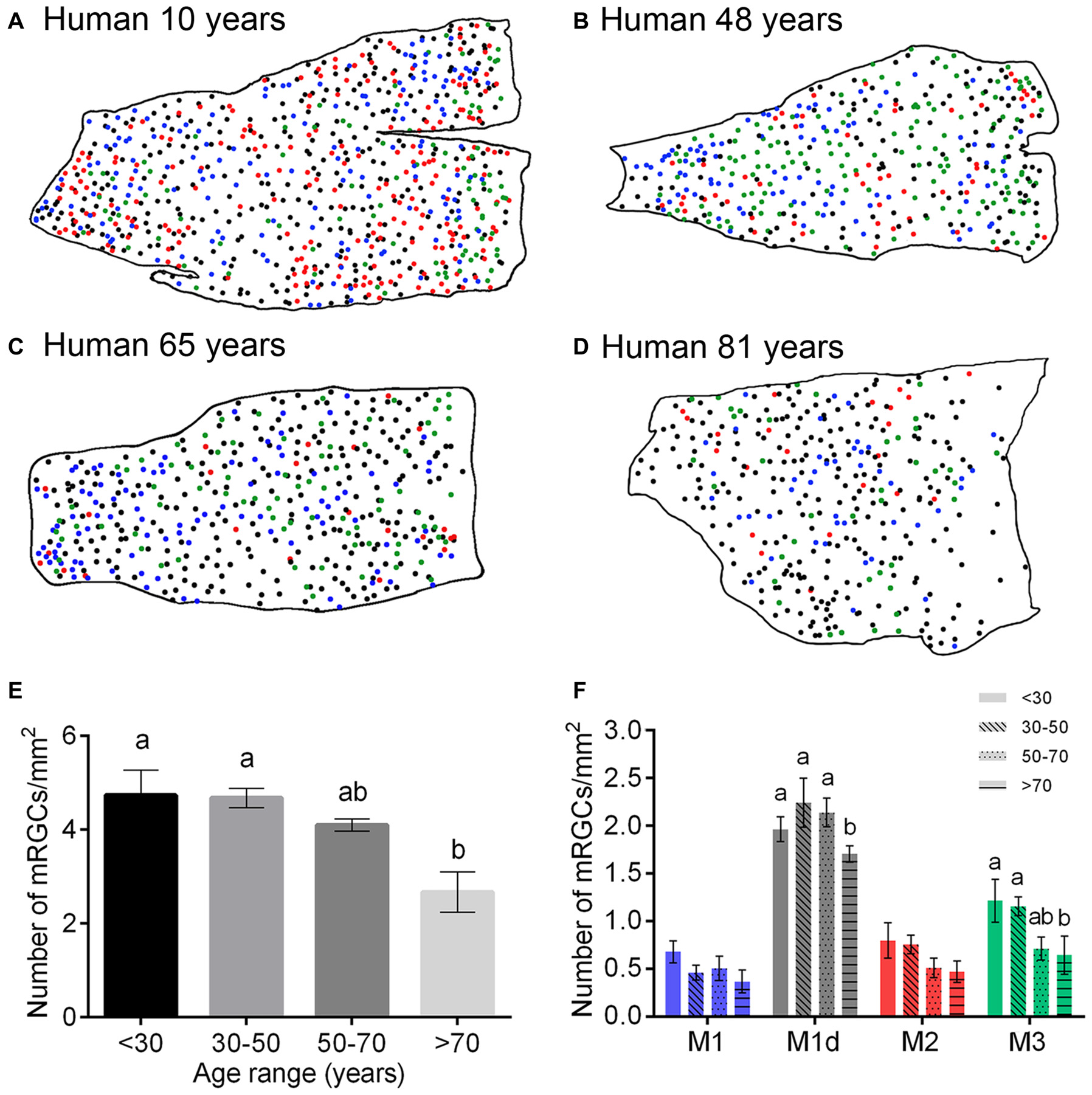 mRGC density and distribution across human aging from age 10 to 81