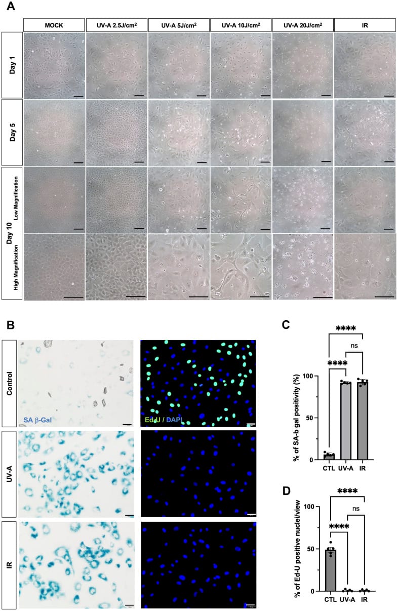 permanent eye aging figure 1 Morphological changes of human corneal endothelial cells after UV-A exposure