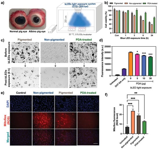 permanent eye aging figure 2 Photoprotective effect of polydopamine nanoparticles in RPE cells against blue light phototoxicity