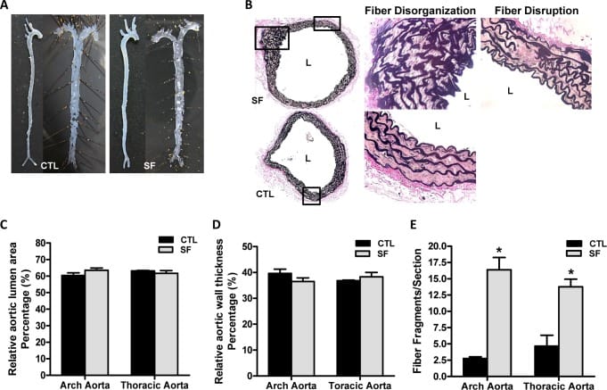Aortic structural changes showing elastic fiber disruption and foam cell infiltration from chronic sleep fragmentation