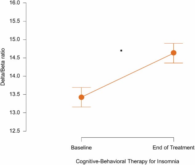 Delta/Beta EEG ratio before and after CBT-I showing reduced cortical hyperarousal